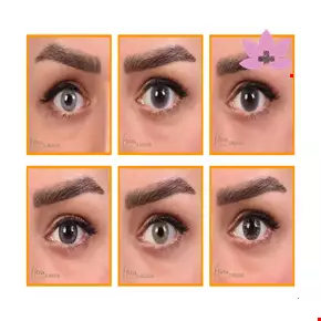 Hera Soft Conract Lens 